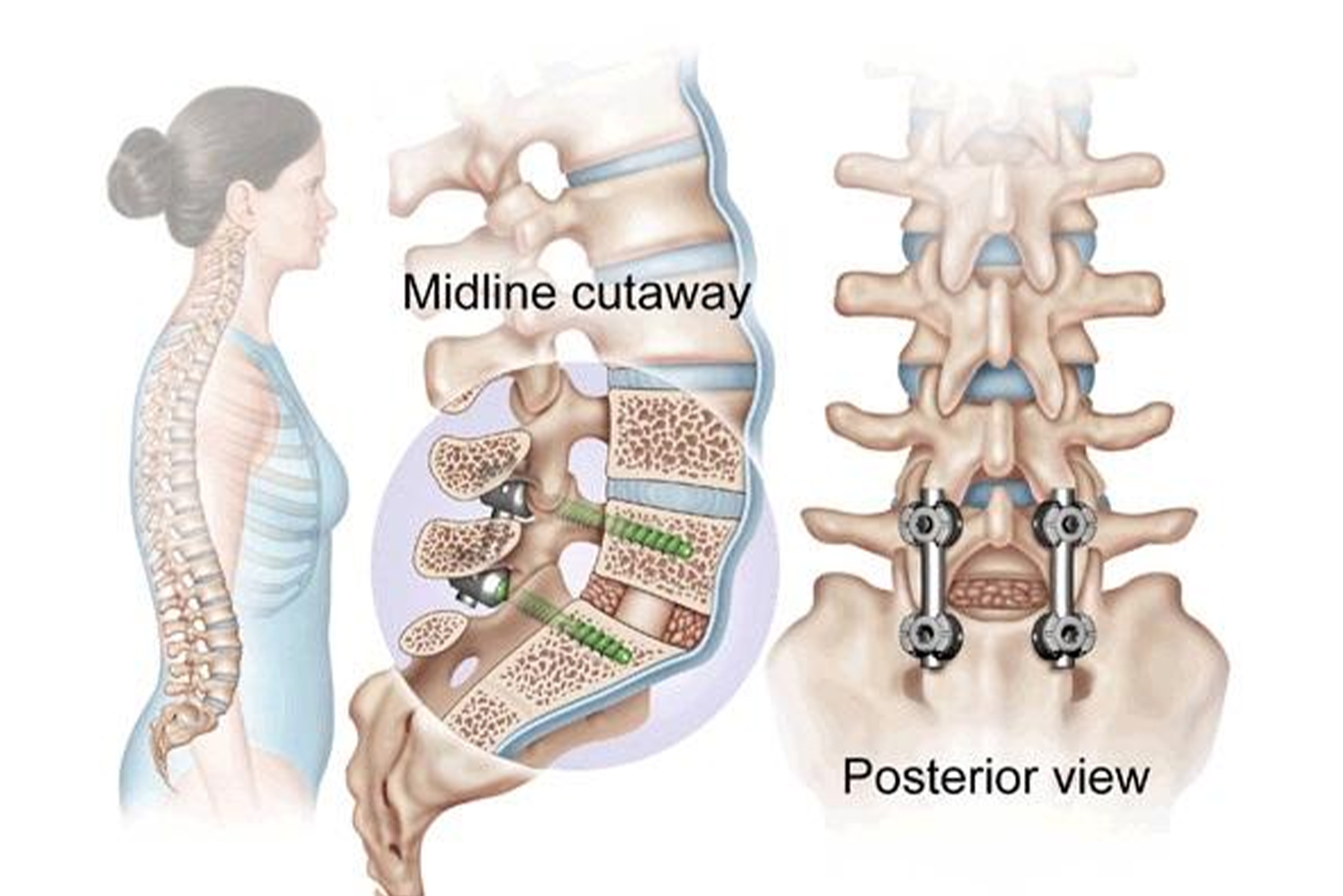 Dr Dheeraj Vishwakarma Endoscopic Neurosurgeon in Jaipur