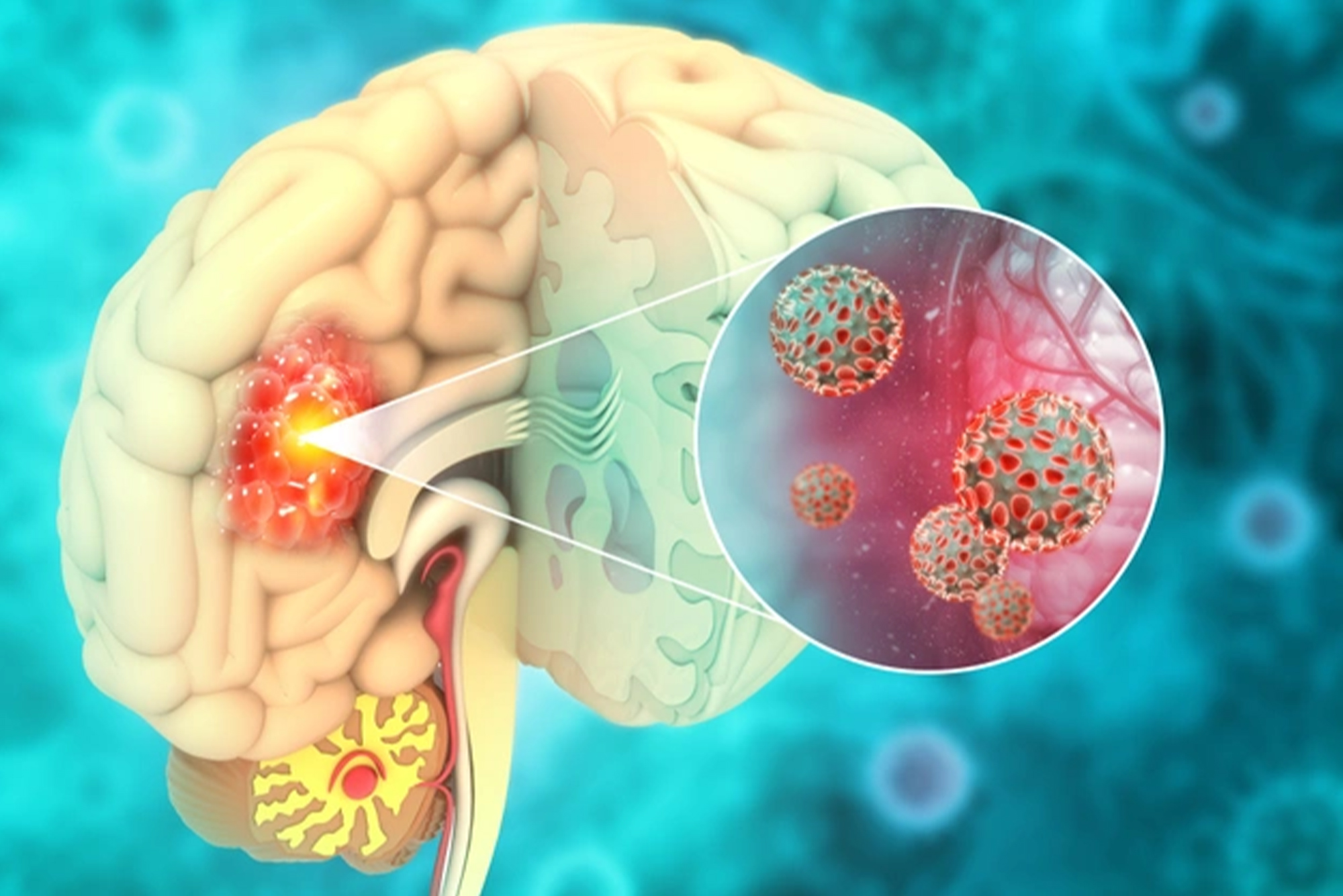 Dr Dheeraj Vishwakarma Endoscopic Neurosurgeon in Jaipur